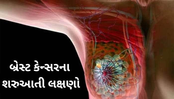 Cancer: બ્રેસ્ટ કેન્સરના પહેલા સ્ટેજમાં દેખાય છે આ લક્ષણો, ઈગ્નોર કરવું પડશે ભારે