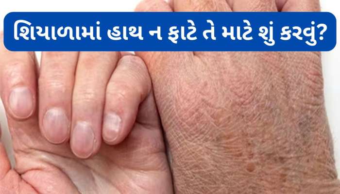 Skin Care: શિયાળામાં હાથની સ્કિન ફાટી જાય છે ? આ 5 વસ્તુઓ લગાડવાથી સ્કિન સોફ્ટ થશે