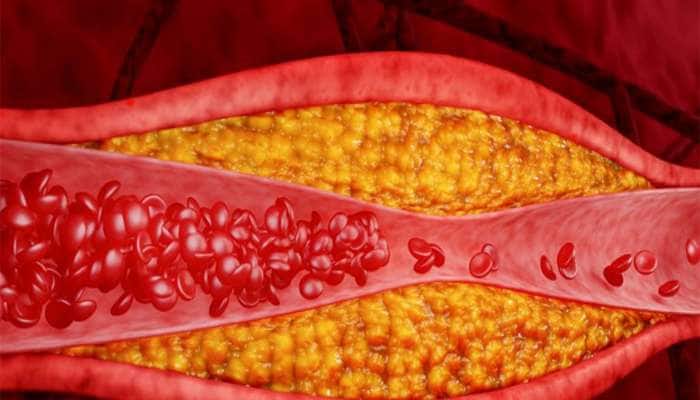 જમ્યા પછી આ વસ્તુ ખાવાથી ઘટી શકે છે કોલેસ્ટ્રોલ, પેટ અને કમરની ચરબી પણ ઓગળવા લાગશે