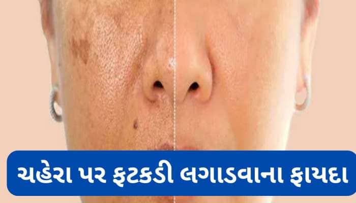 Alum: 5 રુપિયાની ફટકડી સ્કિન પર કરશે જાદુ, ચહેરા પરની ફોડલી, ડાઘનો કરી નાખશે સફાયો