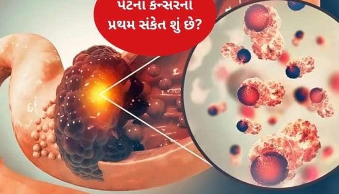 પેટનું કેન્સર થવા પર શરૂઆતમાં જોવા મળે છે આ ગંભીર લક્ષણ, સામાન્ય સમજવાની ભૂલ ન કરો