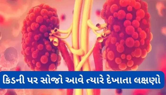 કિડની પર સોજો હોય ત્યારે દેખાય છે આ 5 લક્ષણો, સમયસર ધ્યાન ન આપો તો કિડની થઈ જાય ફેલ