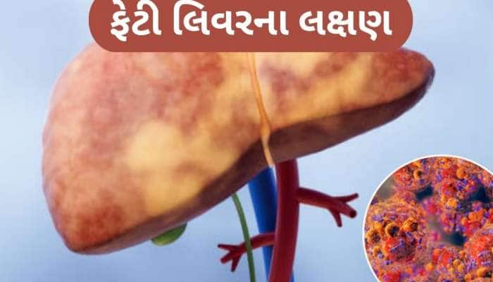ફેટી લિવરને કારણે શરીરના આ ભાગમાં થાય છે દુખાવો, સામાન્ય લક્ષણ સમજી નજરઅંદાજ ન કરો