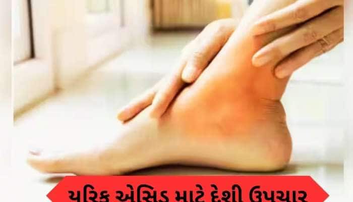 ઘર પર થઈ જશે યુરિક એસિડનો ઇલાજ, દવા લેતાં પહેલા અજમાવો આ ઉપાય