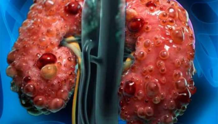 કિડનીની તકલીફવાળાને નુકસાન કરે આ લીલા શાક, ખાવાથી શરીરની અંદર સડવા લાગે કિડની