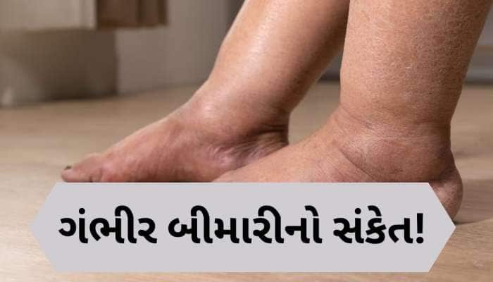 જ્યારે તમારા પગ ચીસો પાડીને કહેશે 'બીમાર છો તમે', આ સંકેતોને નજરઅંદાજ ન કરો