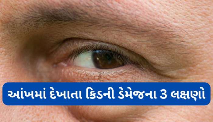 કિડની ખરાબ થાય ત્યારે આંખમાં થાય છે આ તકલીફો, આંખ પર ધ્યાન નહીં આપો તો કિડની પતી જશે