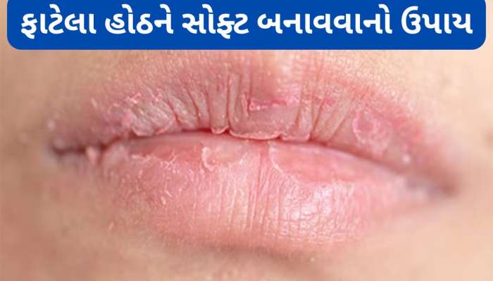 Dry Lips: ફાટેલા હોઠ એક દિવસમાં થઈ જશે સોફ્ટ, આ રીતે લગાડો દૂધ અને ગુલાબના પાન