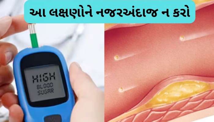 આંખમાં છુપાયેલા છે ડાયાબિટીસ અને કોલેસ્ટ્રોલના લક્ષણો! ટેસ્ટ કર્યા વગર જાણો