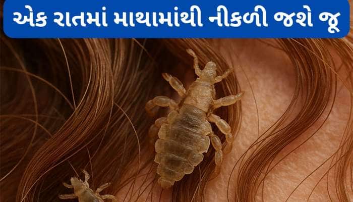 Head Lice: એક રાતમાં નીકળી જશે માથામાંથી જૂ, અજમાવી જુઓ નાળિયેર તેલનો આ નુસખો