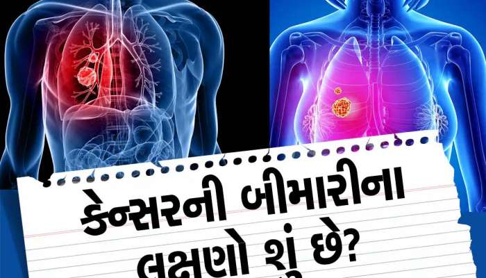 કેન્સરના 7 ચેતવણીરૂપ સંકેતો કયા છે? જાણો કેન્સરની ઓળખ ઘર બેઠા કેવી રીતે કરી શકાય?
