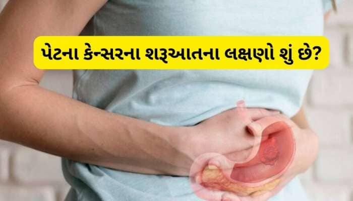 કોઈ કારણ વગર વજન ઘટી રહ્યું છે કે થાક અનુભવાઈ રહ્યો છે? તો હોઈ શકે છે કેન્સરનો સંકેત