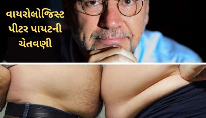 દુનિયાની આગામી મહામારી બનશે બે બીમારી, કંઈ નહિ કર્યુ તો દર્દીની સુનામી આવશે