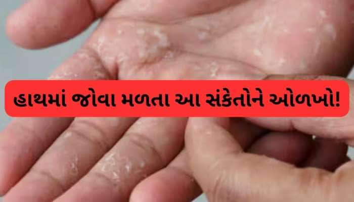 લિવર ખરાબ થાય તો હાથમાં જોવા મળશે આ લક્ષણ, નજરઅંદાજ કરશો તો ભારે પડશે