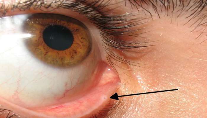 Lacrimal Punctum: તમારી આંખોમાં આ છિદ્ર ક્યારેય જોયું છે? જો નહીં તો તમે ચોંકી જશો